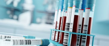 cutting-edge research on detecting cancer earlier